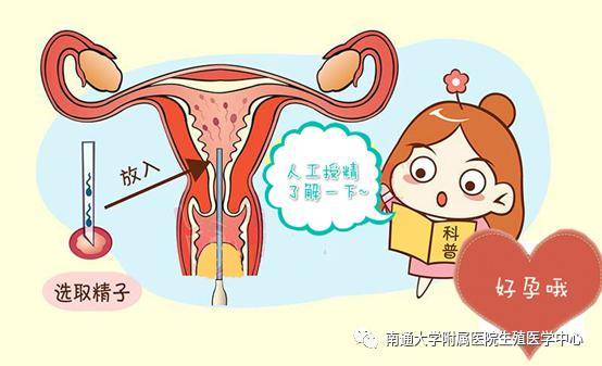 衡水试管婴儿