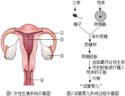 西宁助孕