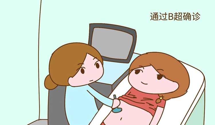 苏州不孕检查