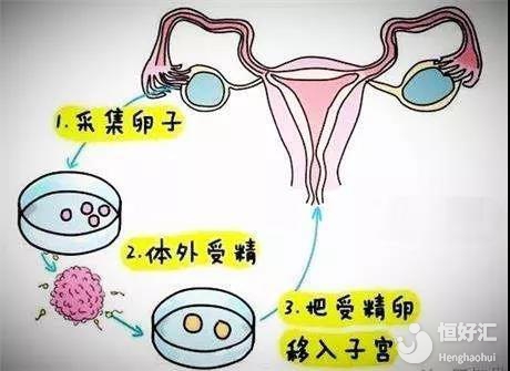 怀孕
